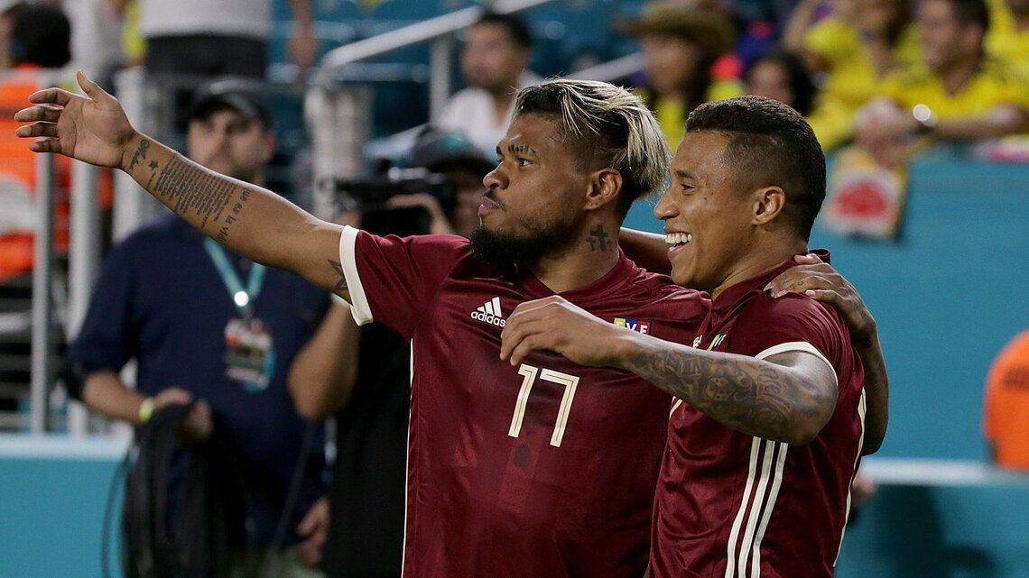 Venezuelan soccer team blocks out politics, vows to ‘bring joy’ in June 1 Miami match