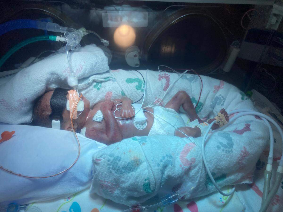 Jayce during his 113-day stay at the NICU.