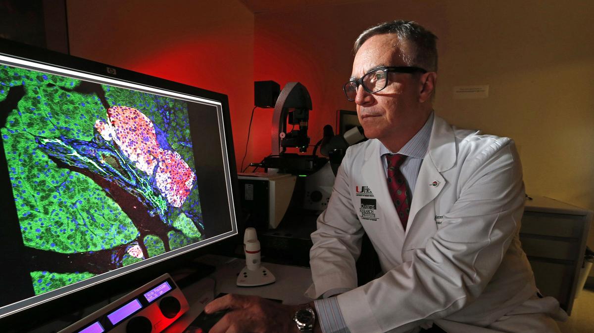 Dr. Camillo Ricordi, of the University of Miami Miller School of Medicine, is working on islet cell transplantation. Diabetes patients who have had the cell transplants are now living without insulin. Ricordi is director of the Diabetes Research Institute, which is currently seeking Type 1 diabetes patients for a clinical trial to test if high doses of omega-3 and vitamin D can halt progression of the disease.