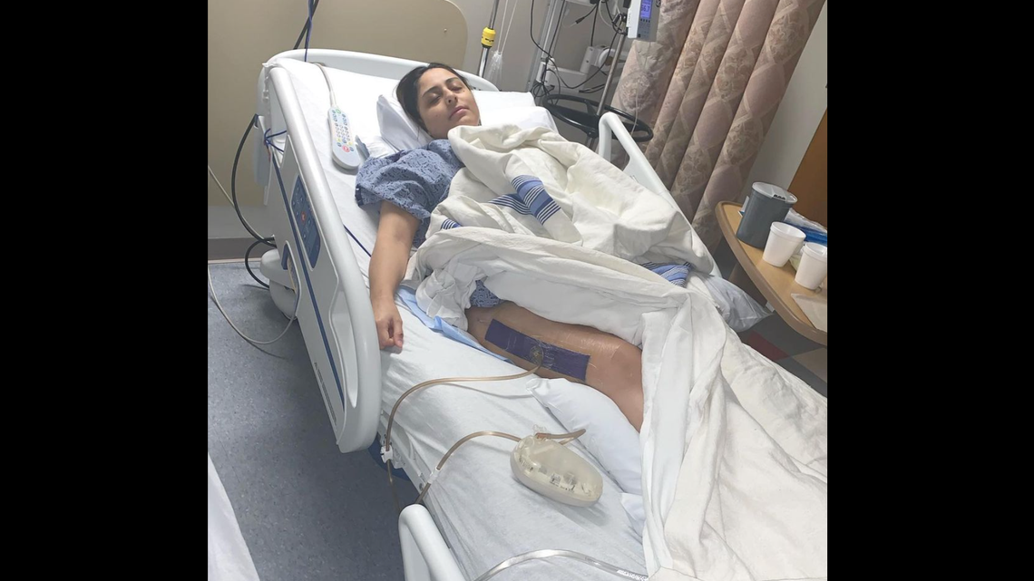 A 23-year-old woman from Massachusetts almost lost her leg after developing a life threatening condition called rhabdomyolysis following a spin class.