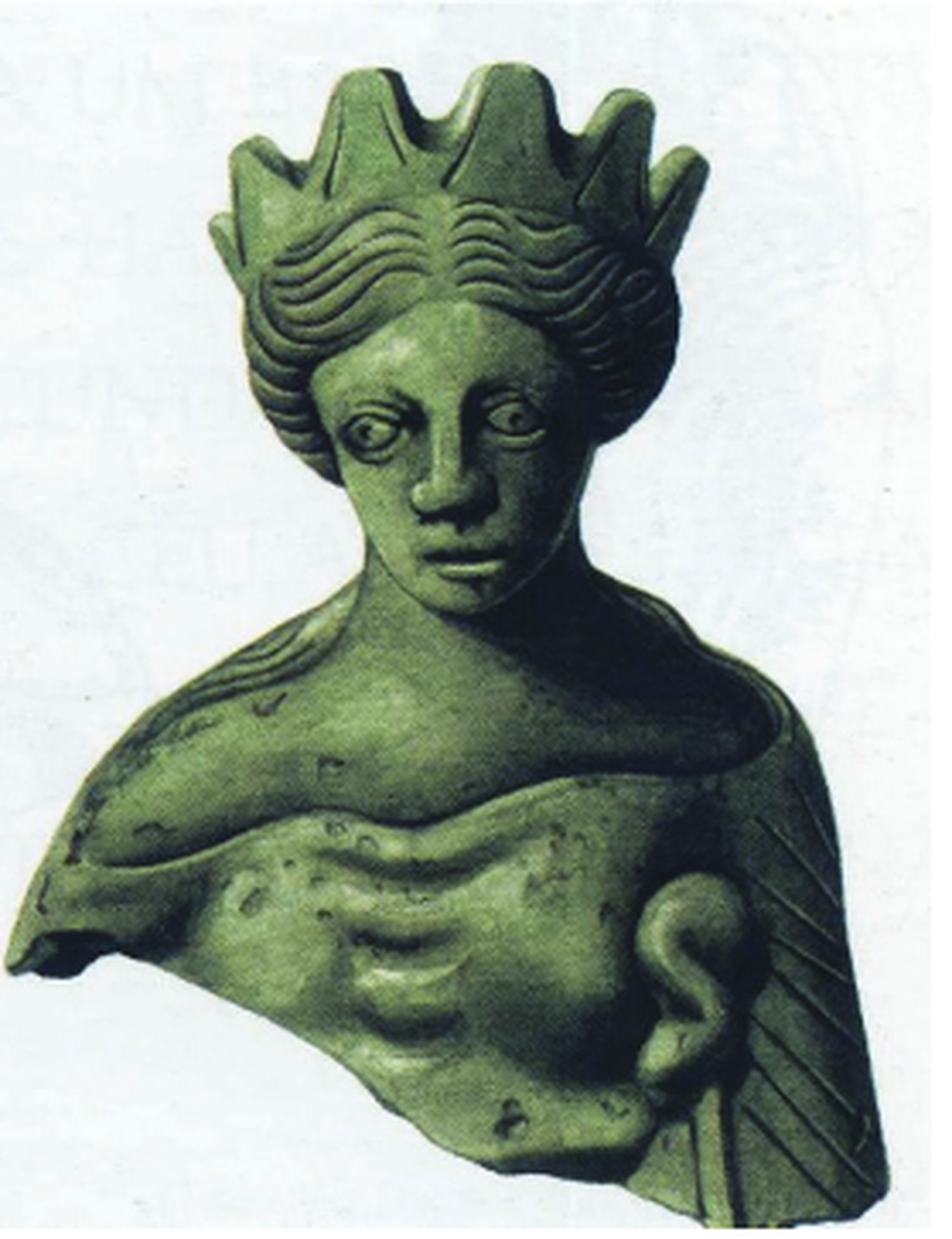 The woman has bulging eyes and deformed facial structures, researchers said.