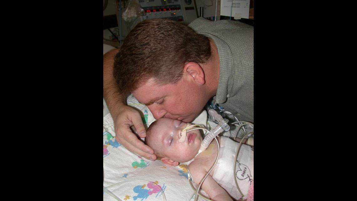 In this file photo from 2002, a Naples father kisses his 4-month-old daughter a week after she received a double-lung transplant at Shands Transplant Center at the University of Florida in Gainesville. The baby, born prematurely, had contracted respiratory syncytial virus, which attacked the mucous membranes and clogged the infant’s air passages.