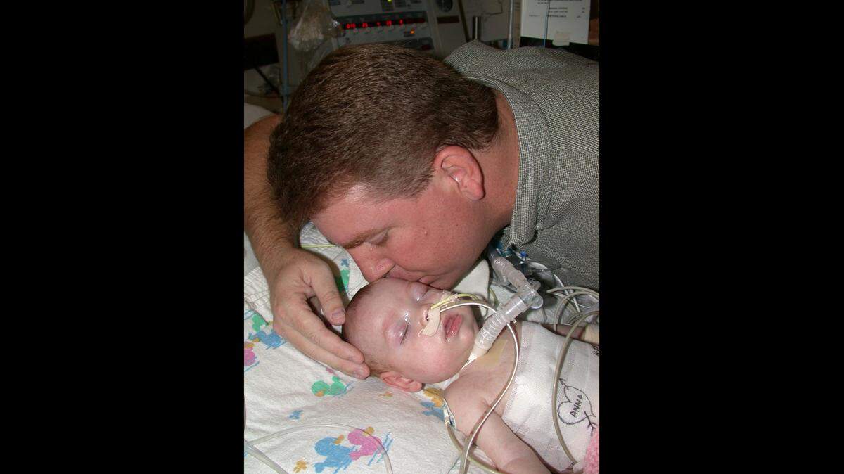 En esa foto del 2002, un padre de Naples besa a su hija de 4 meses una semana después de recibir un doble trasplante de pulmón. La bebé, nacida prematura, había contraido el virus sincicial respiratorio, que le atacó las mucosas y le afectó las vías respiratorias.