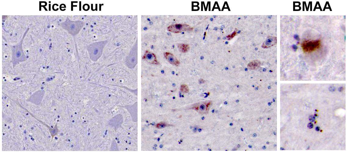 Images from a new study by lead author David Davis, a neurology researcher with the University of Miami Miller School of Medicine, along with Deborah Mash of Nova Southeastern University and Paul Alan Cox of the Brain Chemistry Labs, reveal that toxin exposure produced by blue-green algae (GMAA) and motor neurons of vervet monkeys were similar to ALS patients. These changes were not seen in rice flour controls.