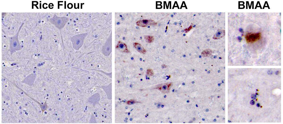 Images from a new study by lead author David Davis, a neurology researcher with the University of Miami Miller School of Medicine, along with Deborah Mash of Nova Southeastern University and Paul Alan Cox of the Brain Chemistry Labs, reveal that toxin exposure produced by blue-green algae (GMAA) and motor neurons of vervet monkeys were similar to ALS patients. These changes were not seen in rice flour controls.