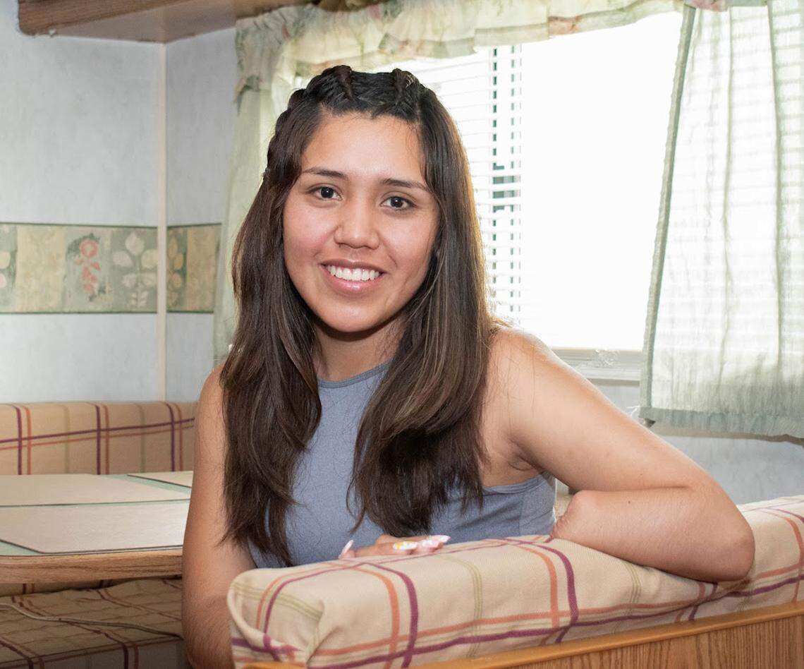 Brigite Valverde, 24, lost her left hand in an industrial accident. She needs a functioning prosthetic to care for herself.