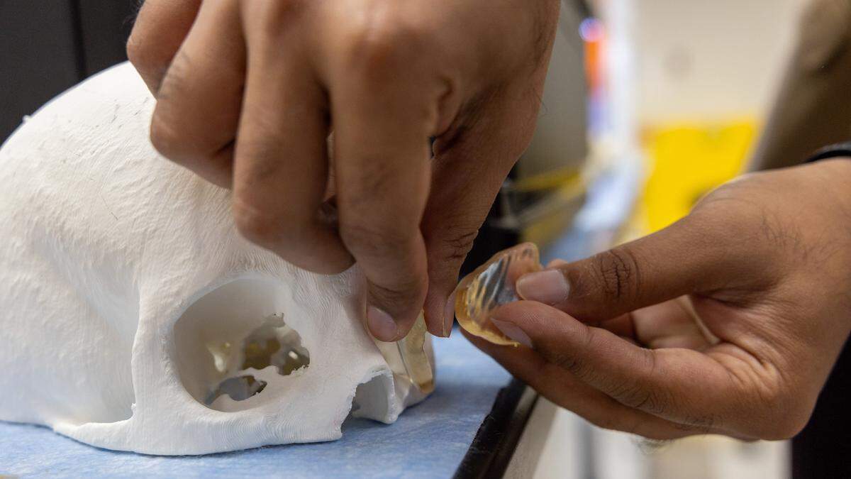 Vasudev Vivekanand Nayak, the 3D-bioprinting facility’s operational manager, places customized yellow 3D-printed surgical guides on a 3D-printed skull model at the 3D Bioprinting Facility at the University of Miami Miller School of Medicine in Miami on Tuesday, June 2, 2026.