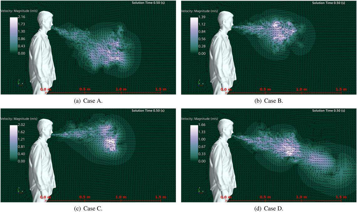 Sneeze velocity for four different nose and mouth types is shown. A is open nasal passage with teeth, B is open nasal passage without teeth, C is blocked nasal passage without teeth, and D is blocked nasal passage with teeth.