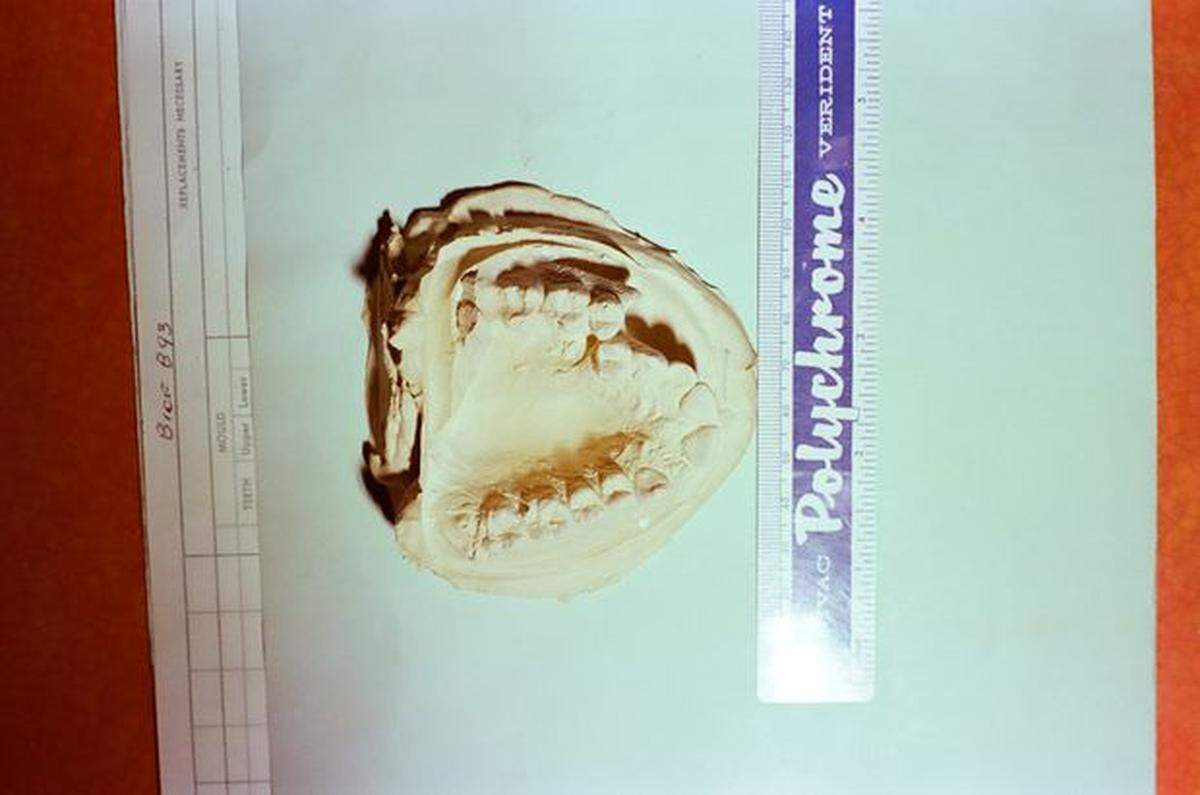 A model depicting the teeth of Robert DuBoise, created during the 1983 murder investigation.