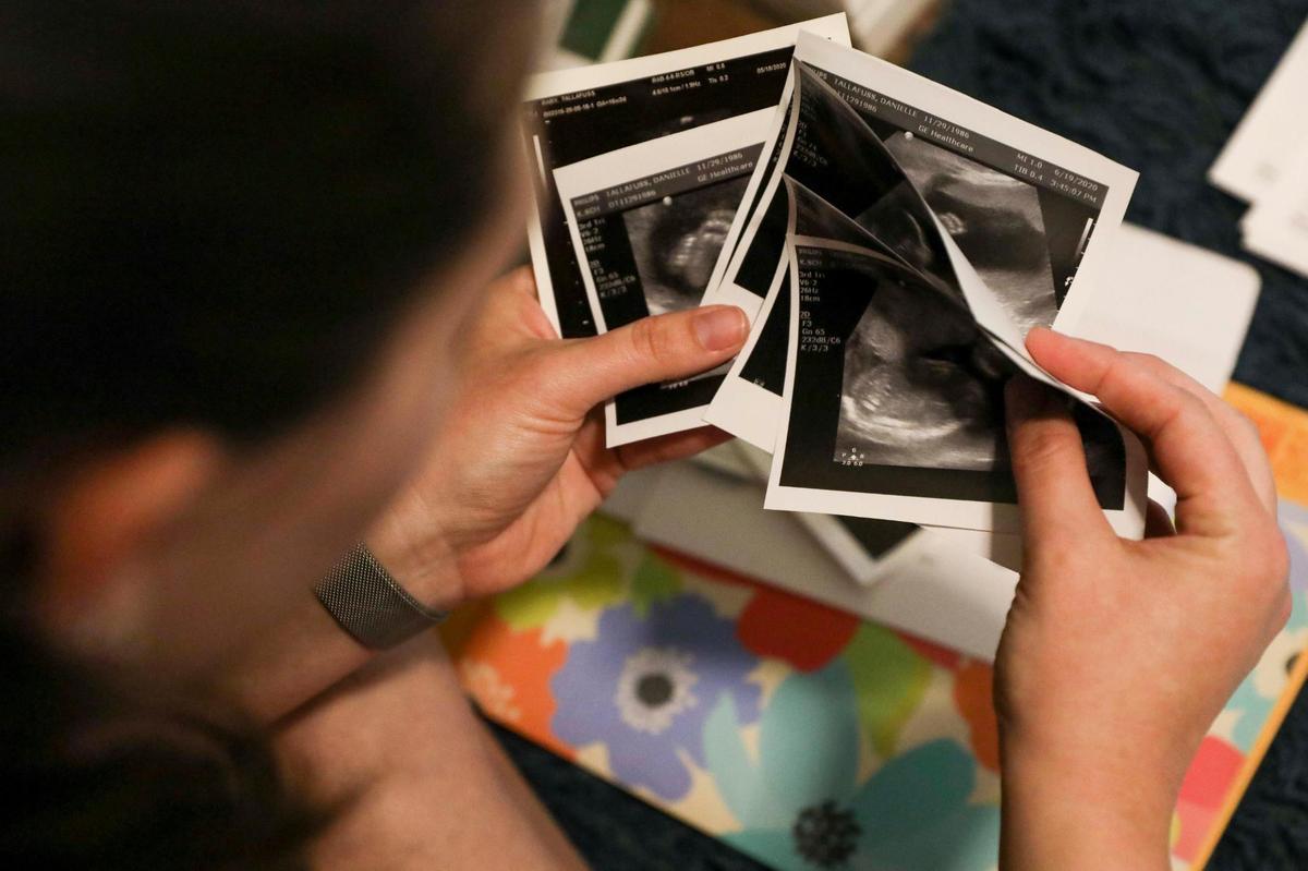 Danielle Tallafuss shows sonograms of her son Nathaniel, which she keeps with the medical documents stored in her bedroom closet, on Monday, Feb. 21, 2022. Danielle and her husband decided to terminate her pregnancy at 22 weeks after learning that Nathaniel would have been born with hypoplastic left heart syndrome. The Florida Legislature is trying to pass a bill that would prohibit abortions after 15 weeks of pregnancy, with few exceptions.