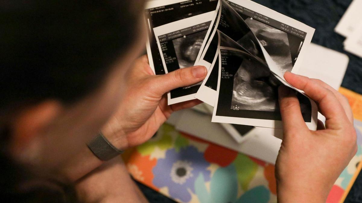 Danielle Tallafuss shows sonograms of her son Nathaniel, which she keeps with the medical documents stored in her bedroom closet, on Monday, Feb. 21, 2022. Danielle and her husband decided to terminate her pregnancy at 22 weeks after learning that Nathaniel would have been born with hypoplastic left heart syndrome, an underdevelopment of the left side of the heart, to protect their child from the toll his condition would take on his life.