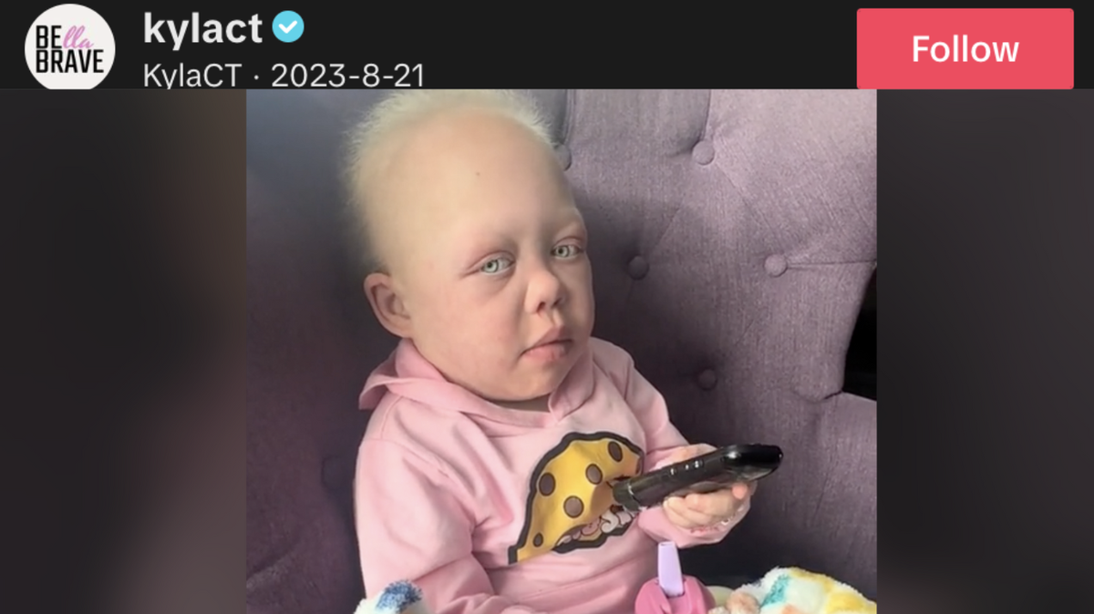 On July 15, Bella Brave’s mom shared the heartbreaking news; her beloved 11-year-old daughter had passed away.