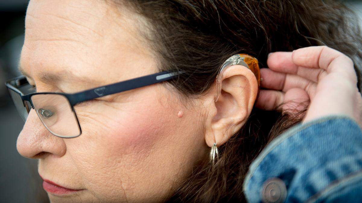 Millions of people may be able to buy hearing aids over-the-counter by the fall, under a long-awaited rule finalized Aug. 16 by the FDA.