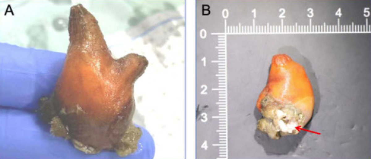 The sea squirts are generally “potato-shaped” and start their life more like tadpoles before rearranging their organs.
