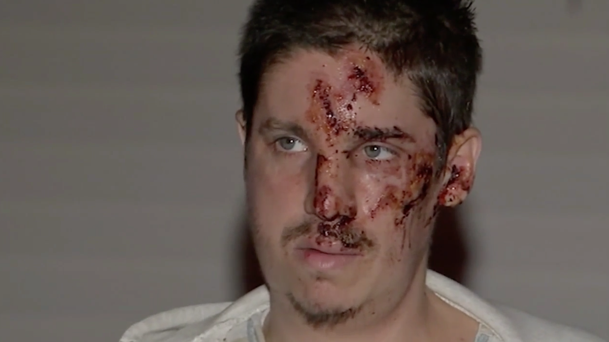 Daniel Peterson said he was attacked in Egg Harbor City, New Jersey, while trick-or-treating on Halloween with his teen cousin Ethan Drey. Both went to hospital, as police investigate the South Jersey assault.