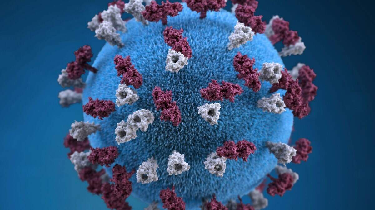 Measles is a highly contagious virus, but infection can be less severe or prevented with vaccination.