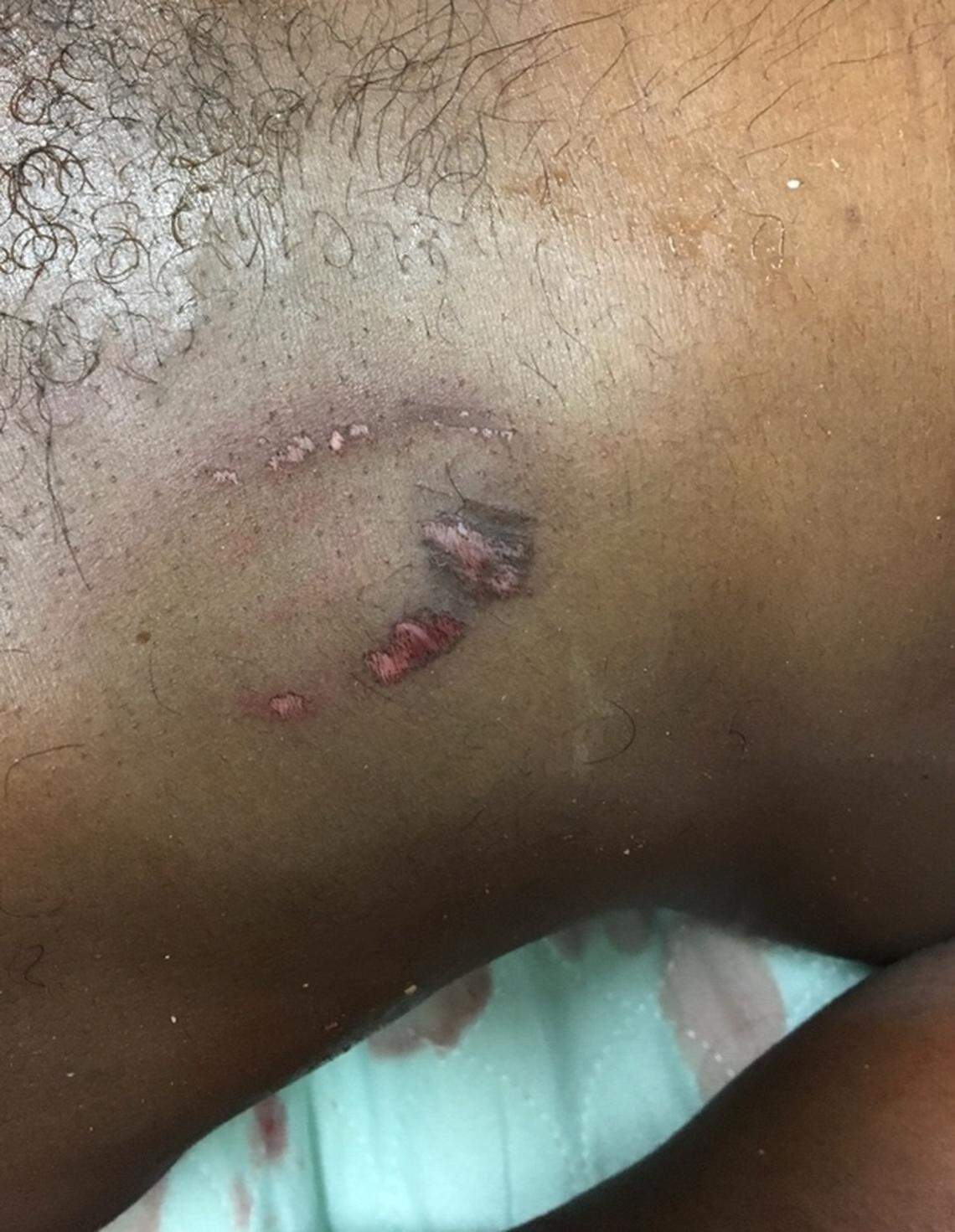 Bruises and lacerations can be seen covering Timothy Thomas' body in postmortem photos provided by the family.