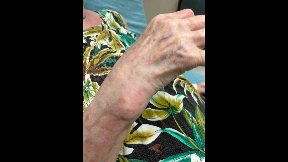 The 83-year-old suffered injuries to her wrist when she refused to give a bonus to the suspect, the Brevard County Sheriff’s Office says.