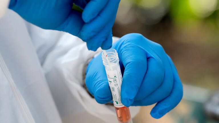 Already had COVID? You can still get infected with the omicron variant. What to know