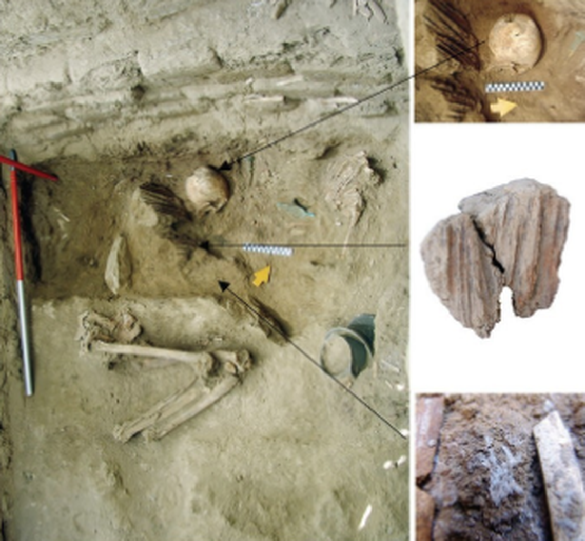 The remains of a man likely with a bone disease was found with sacrificed animal remains.