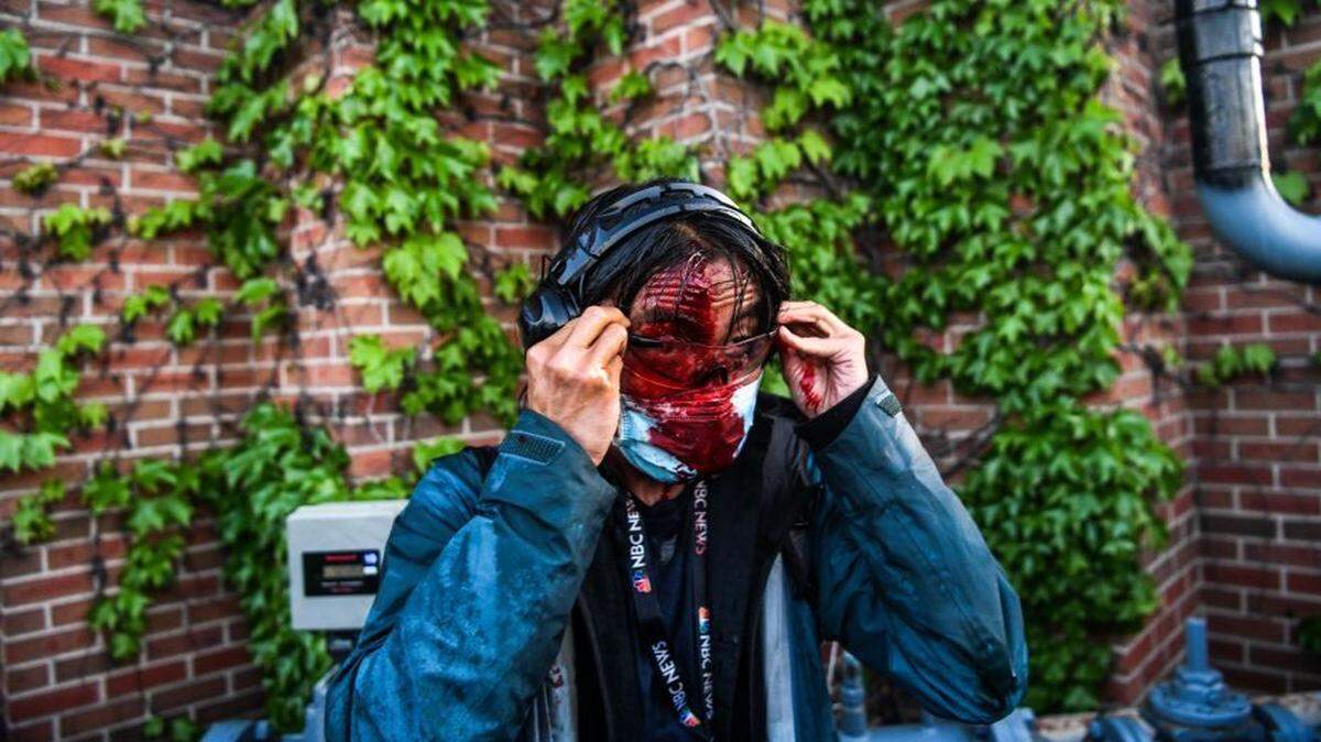 A member of the media is seen bleeding after police fired tear gas and rubber bullets following a Minneapolis demonstration calling for justice for George Floyd.