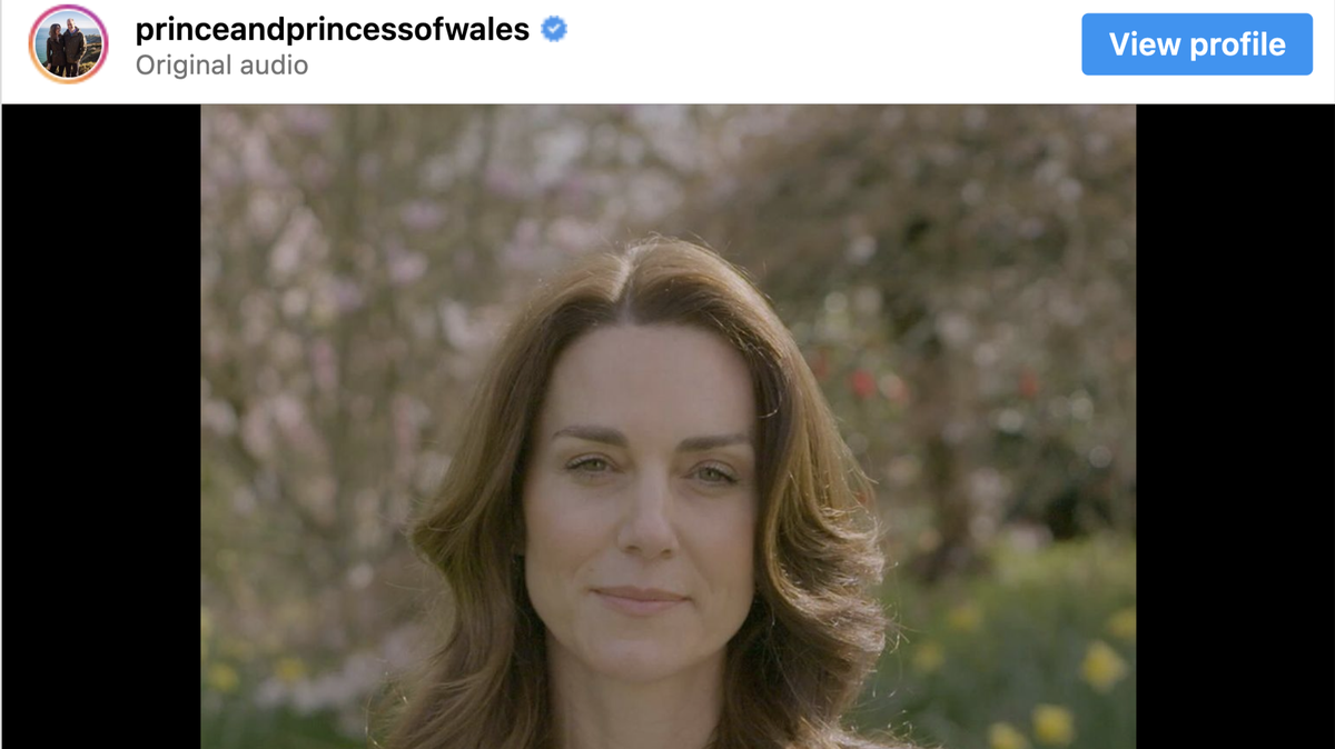 Kate Middleton shares devastating diagnosis months after undergoing surgery.