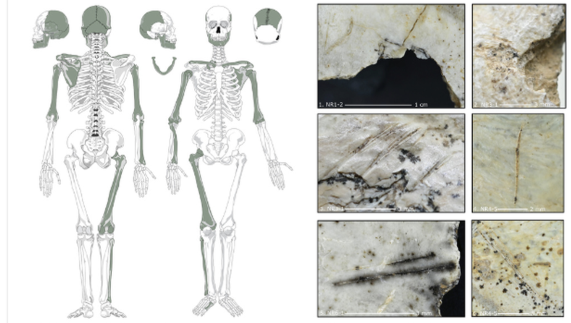 Cut marks on the bone show that those manipulating the bodies sought after the most nutritious parts, researchers said.