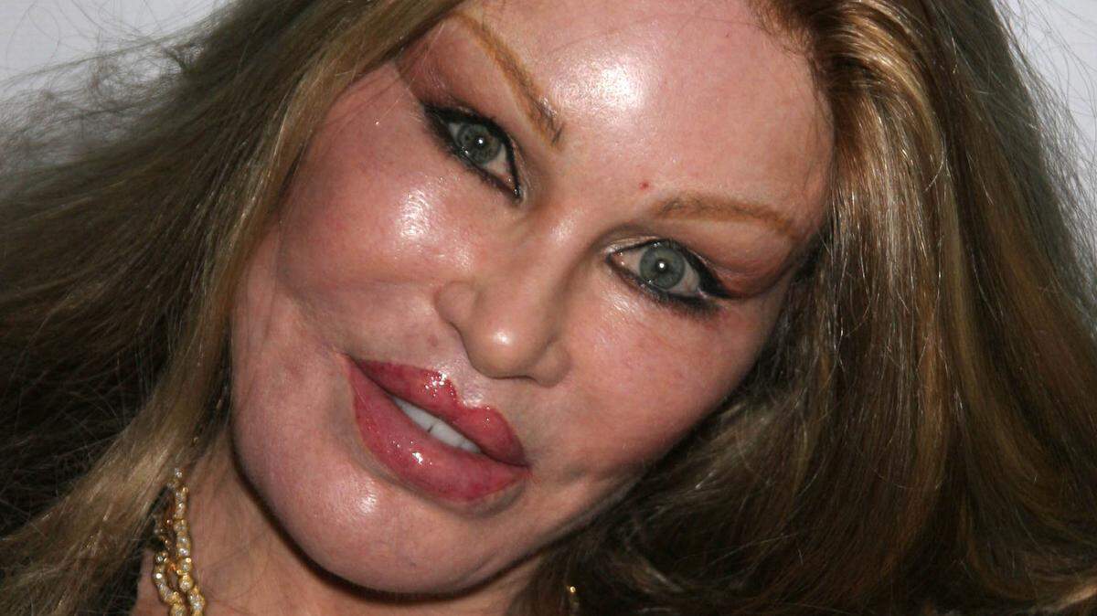 Jocelyn Wildenstein died while napping on Dec. 31.