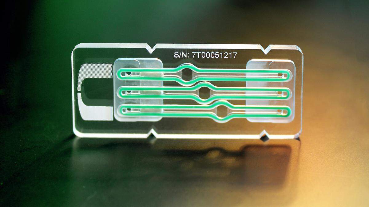 The University of Florida, working with a team of researchers, including from the University of Miami, has been awarded a $5 million grant from the National Institutes of Health to continue their work on a “pancreas on a chip,’’ featured above, which is a platform that mimics the pancreatic beta cells, which are responsible for secreting insulin.