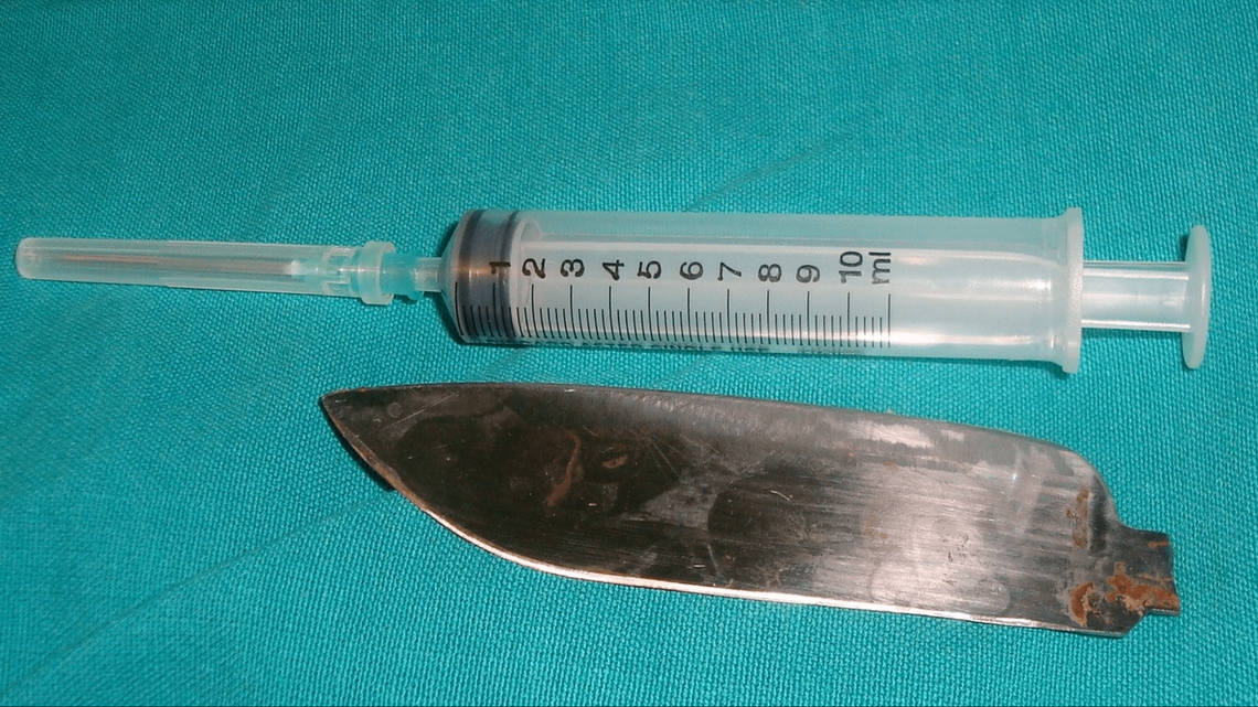 The blade was nearly six inches long, doctors said.