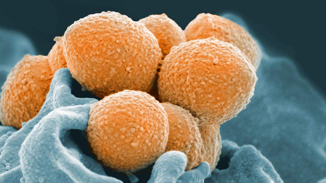 This handout image provided by the National Institute of Allergy and Infectious Diseases shows an electron microscope image of Group A Streptococcus (orange) during phagocytic interaction with a human neutrophil (blue).