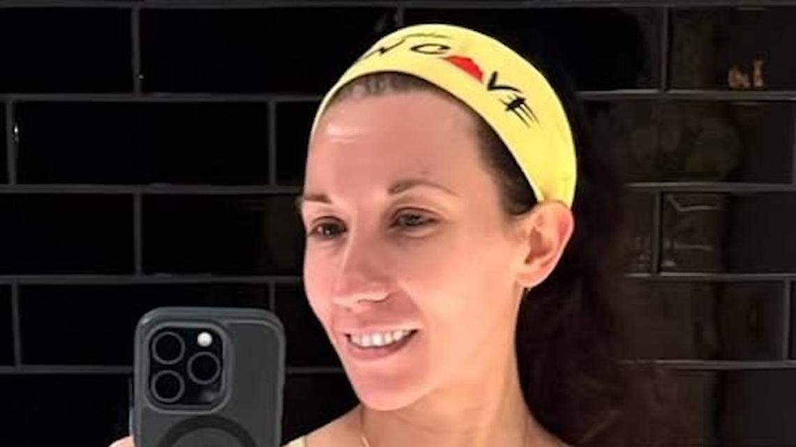 runner bit by dog during race