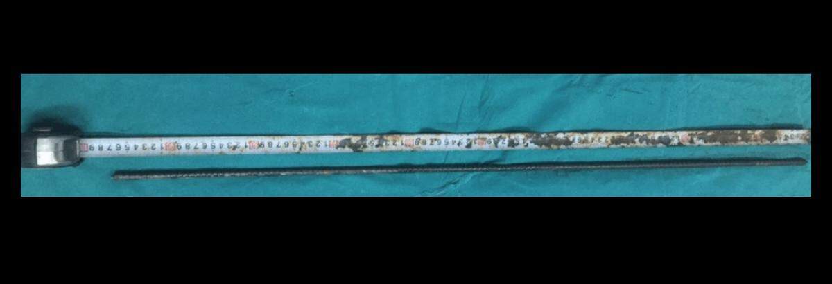 The iron rod had a small diameter that helped minimize the brain damage it caused.