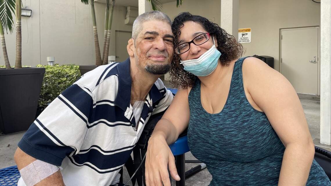 ‘The most grateful patient’: Badly burned at age 2, he’s had medical issues ever since