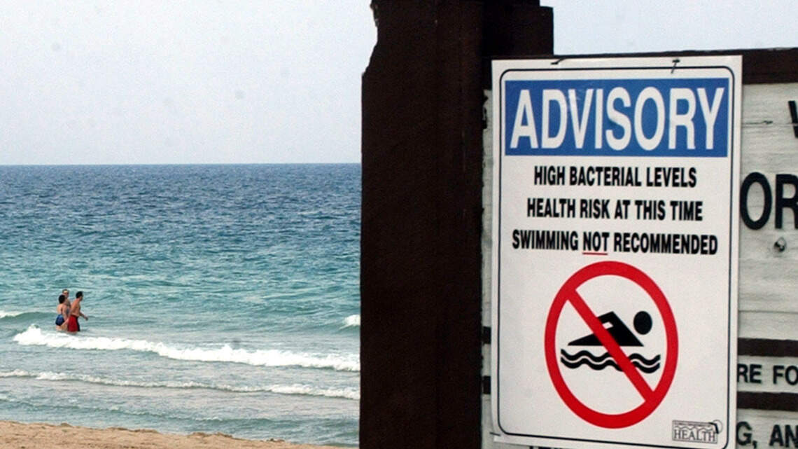 Swim advisory gets issued after excessive fecal matter found at this Miami-Dade beach