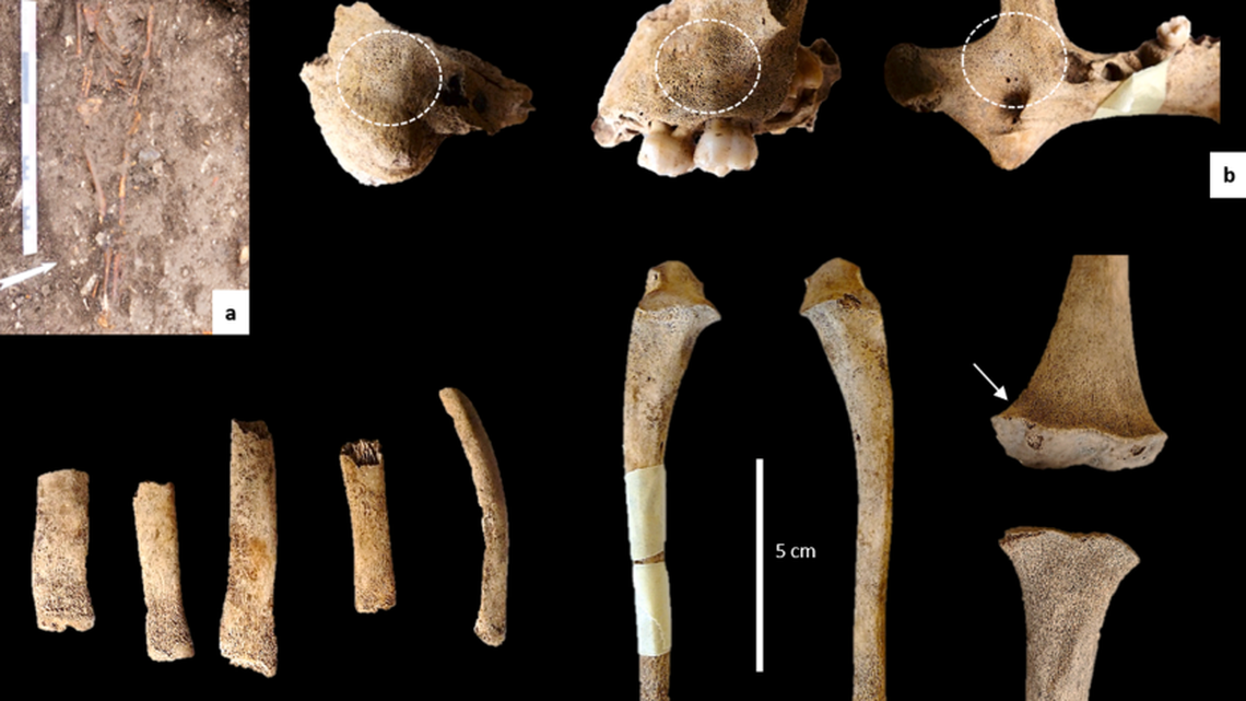 The bones of a 19th-century toddler show medical experimentation was taking place during the industrialization of France.