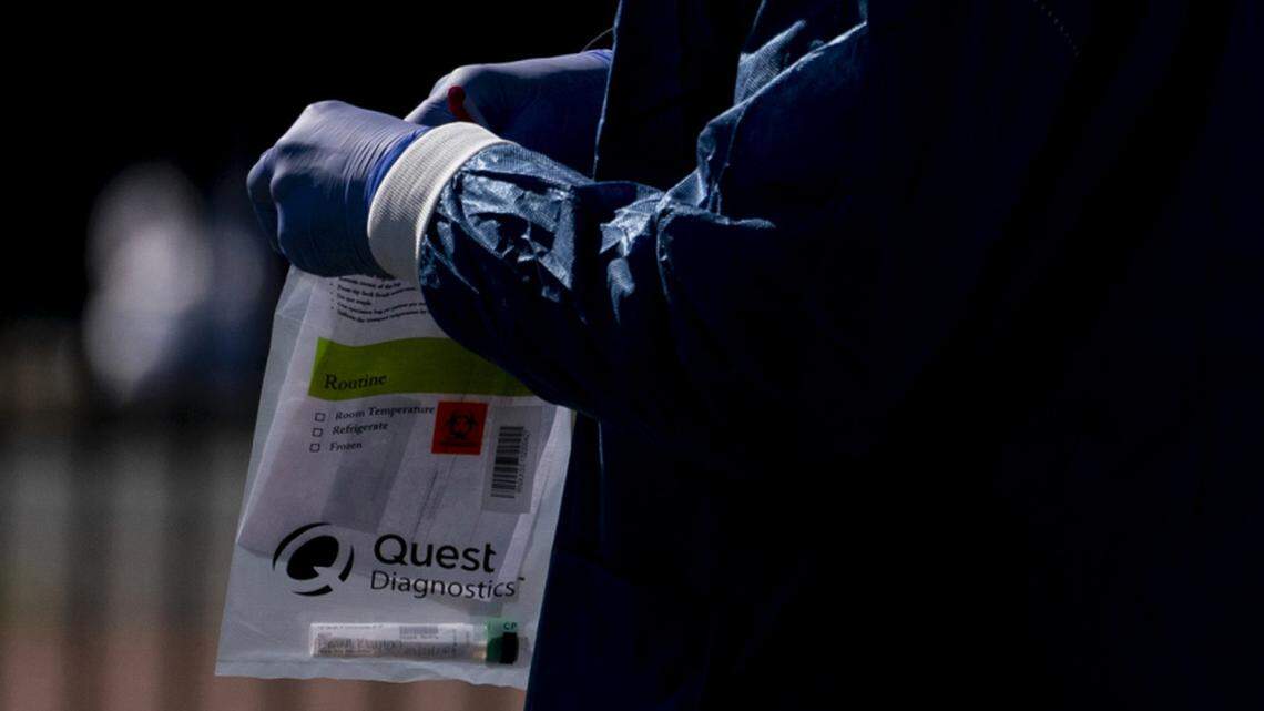 A Children’s National Hospital healthcare worker holds a Quest Diagnostics bag containing a Covid-19 swab at a coronavirus drive-thru testing site at Trinity Washington University in Washington, D.C., U.S., on Thursday, April 2, 2020. The White House’s presentation of projections for coronavirus fatalities to extend into the start of the summer will reinforce fears for extended shutdowns that spur deep declines in U.S. output and employment. Photographer: Andrew Harrer/Bloomberg via Getty Images