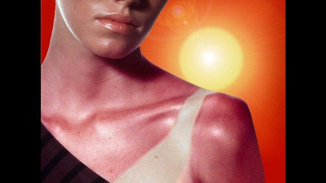 Basal cell carcinoma (BCC) is the most common type of skin cancer,  with about 3.6 million U.S. cases diagnosed annually. Treatments range from Moh's excisions  to topical and radiation therapies.