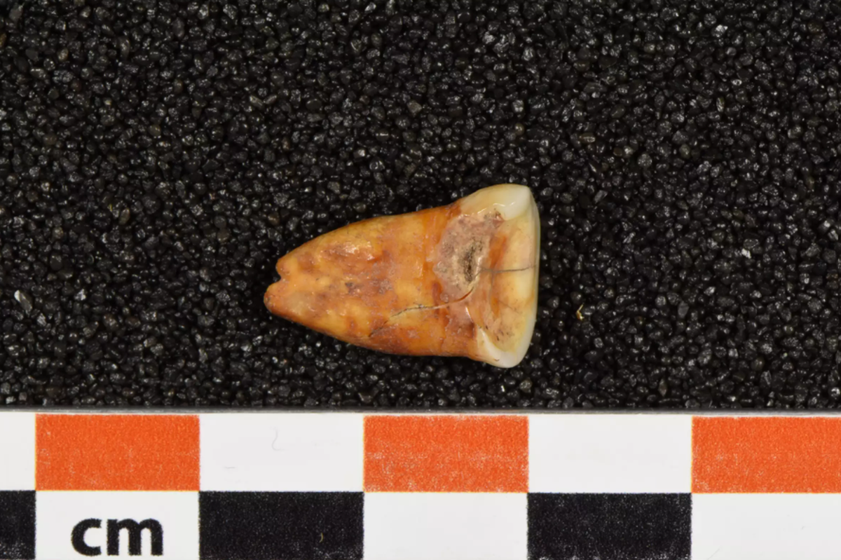Researchers can learn what ancient people ate by analyzing the isotopes in their teeth enamel.