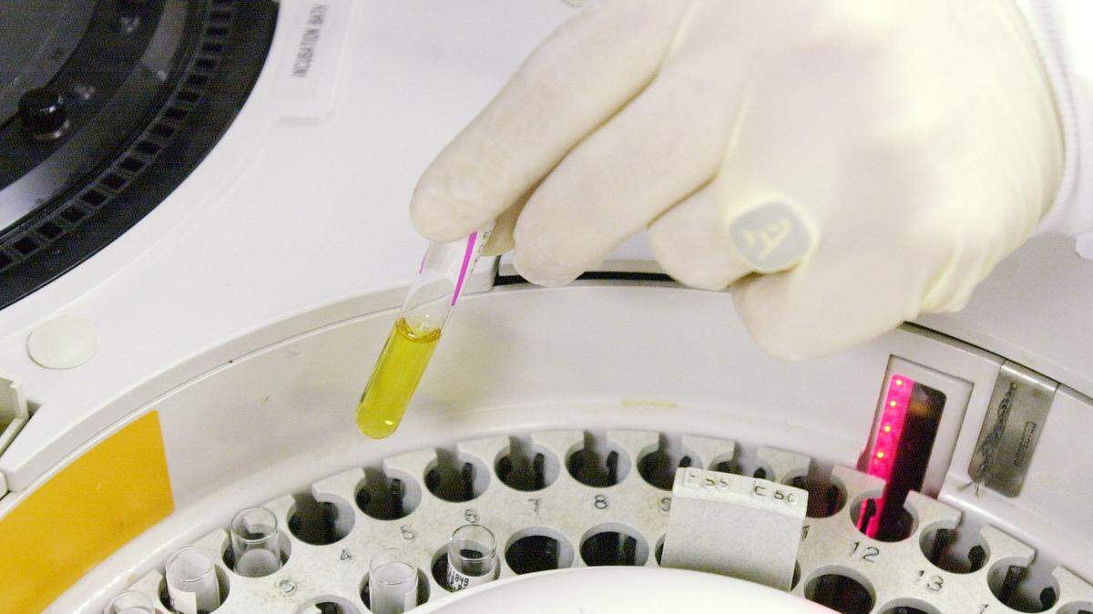 In the charges against Adam Adler, an Aventura man who owned substance abuse treatment centers, patients’ urine samples were sent to labs that paid him kickbacks, according to law enforcement authorities.