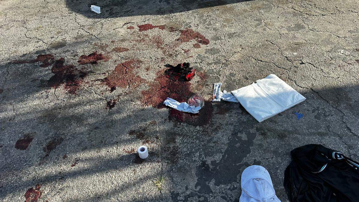 Blood and discarded clothing could be seen in the driveway of the Miami-Dade home where sheriff’s deputies said they found three men with stab wounds on Thursday morning, May 1, 2025.