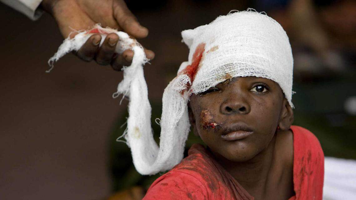 An injured survivor receives treatment at a medical clinic set up at MINUSTAH’s logistics base in Port-au-Prince, Haiti, the day after the 7.0 magnitude earthquake of Jan. 12, 2010.