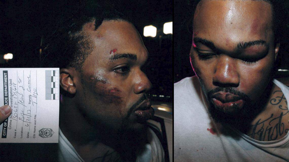 Photos taken after the June 2013 arrest of Francois Alexandre show the extent of his injuries at the hands of Miami Police. He sustained a broken eye socket and scrapes across his face. The photos were made public as a part of Alexandre’s civil lawsuit against the officers who arrested him.
