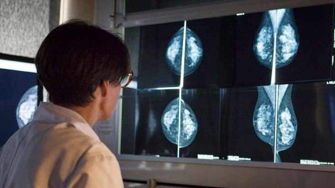 A radiologist examines the results of mammograms.