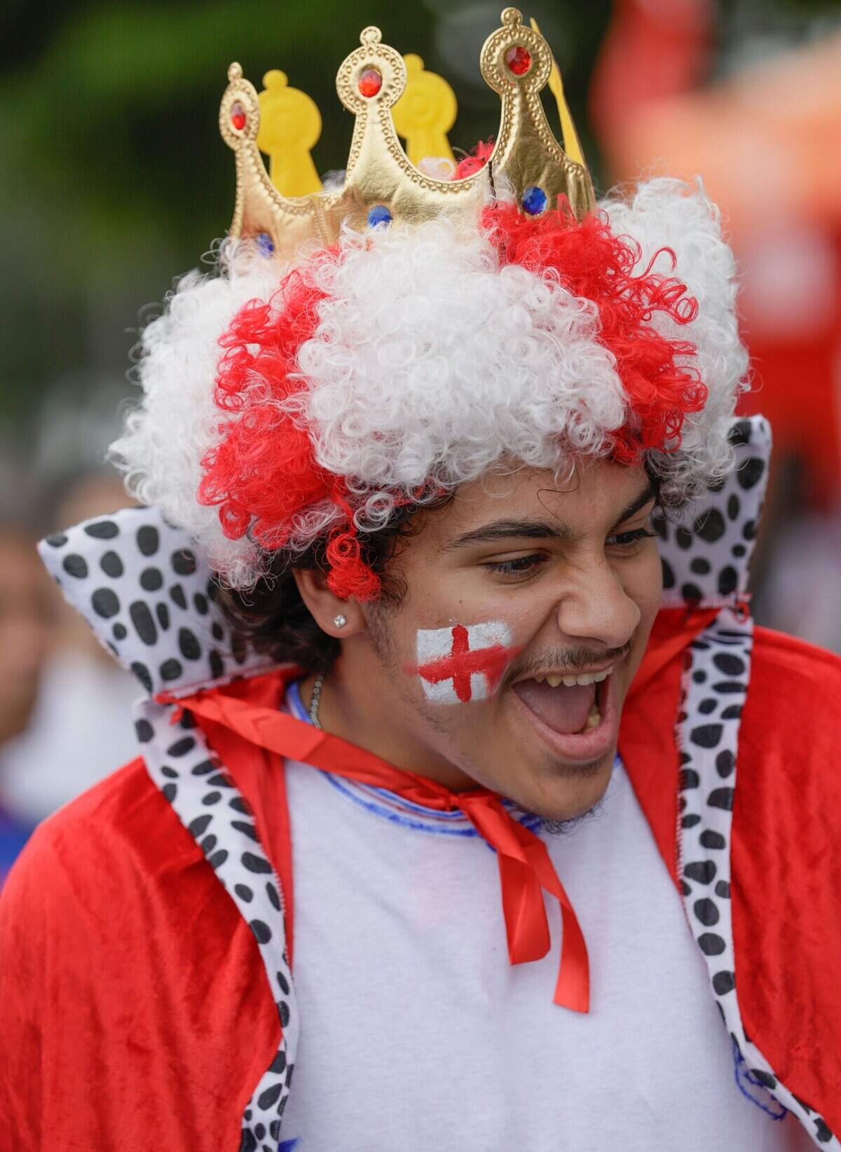 England fan, Tyler Guardado arrives before the start of FIFA World Cup 2026 third-place soccer match between France and England at Hard Rock Stadium (Miami Stadium) on Saturday, July 18, 2026 in Miami Gardens, Fla.