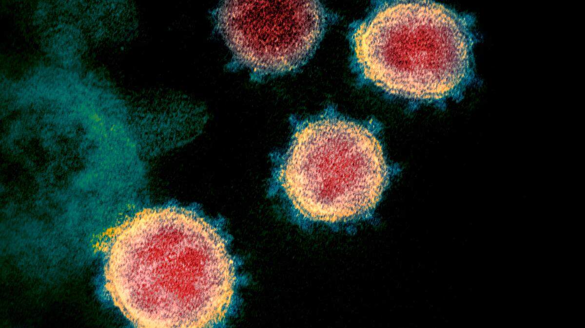 This undated electron microscope image made available by the U.S. National Institutes of Health in February 2020 shows the virus that causes COVID-19.