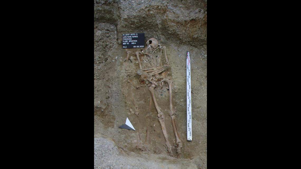 A prosthetic hand was discovered in an approximately 400-year-old grave, according to officials in Germany.