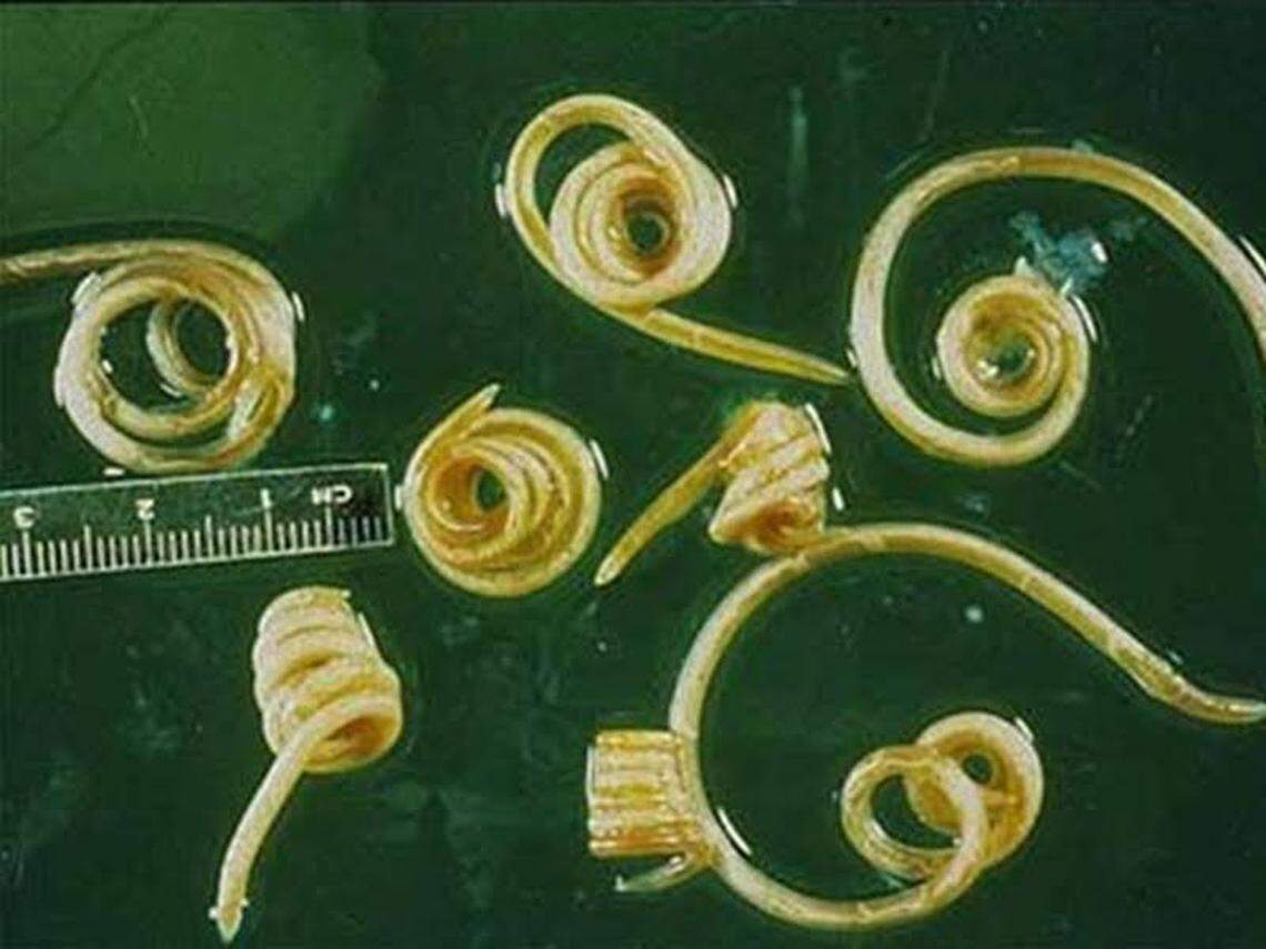 Roundworm image.