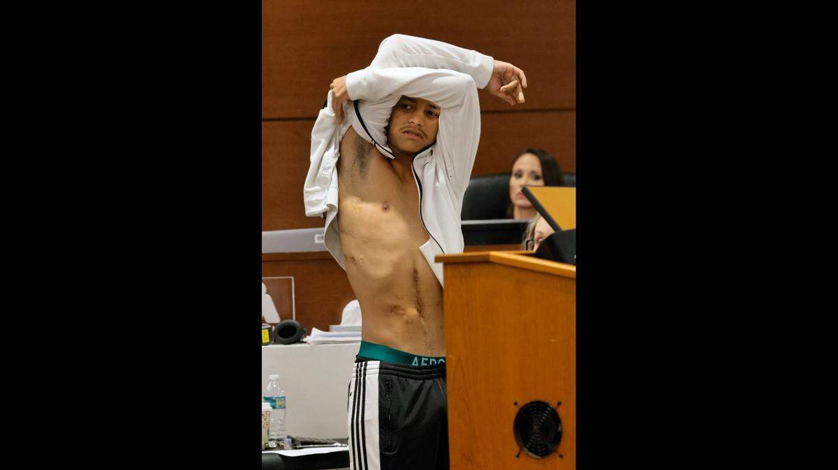 Former Marjory Stoneman Douglas High School student Anthony Borges shows scars from his gunshot wounds to the jury on Wednesday, July 20, 2022. He was shot five times. Shooter Nikolas Cruz, who pleaded guilty to 17 counts of premeditated murder and 17 counts of attempted murder in the 2018 shooting at the Parkland school, is in the penalty phase of his trial at the Broward County Courthouse in Fort Lauderdale.