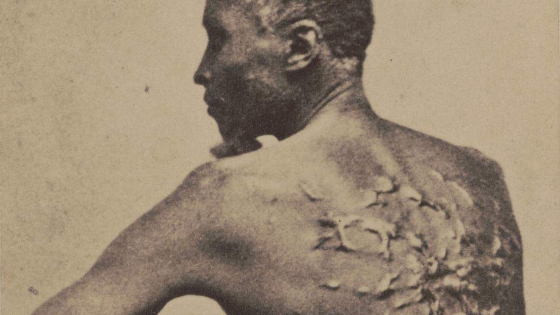 Scars cover the back of enslaved man who’s photograph has been named ‘Whipped Peter.’